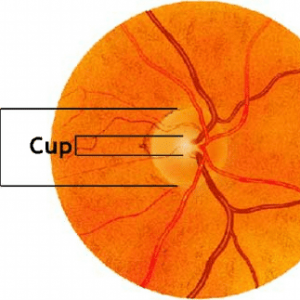 CUP,RATIO,ROUND,GENERIC,5.0:1/5.5:1